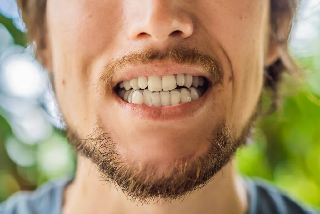 Улыбка с зубами фото мужчина борода. Картинка зубы защищаются. Сильно сжатые зубы