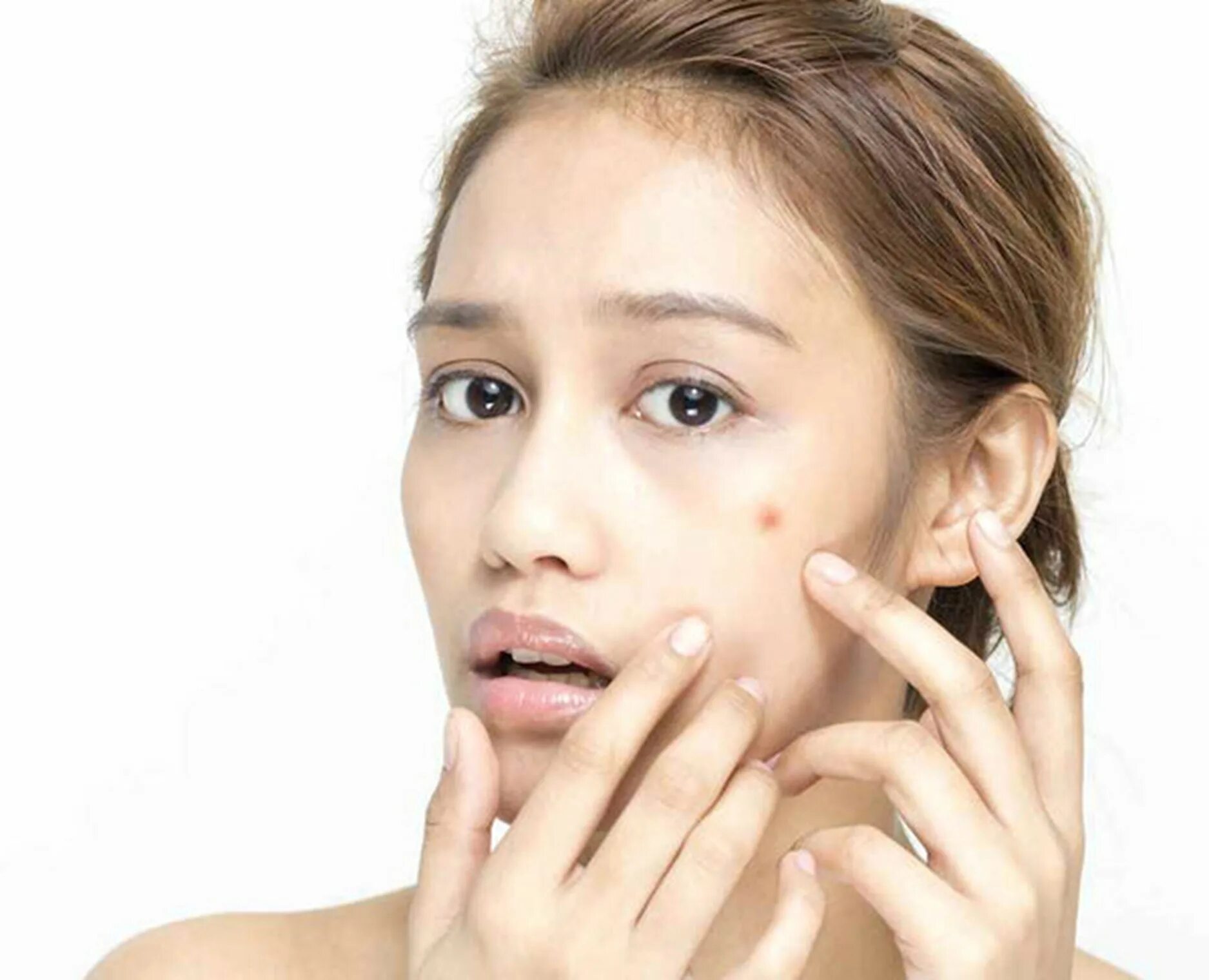 Глаза. Cares acne skin care. Cares acne skin care. Cares acne skin care. Cares acne skin care.