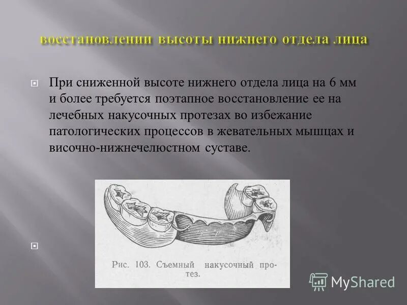 снижение высоты нижнего отдела лица. возрастные изменения нижней трети лица. высота нижнего отдела лица это. нижняя треть лица уменьшена. определение нижнего отдела лица.
