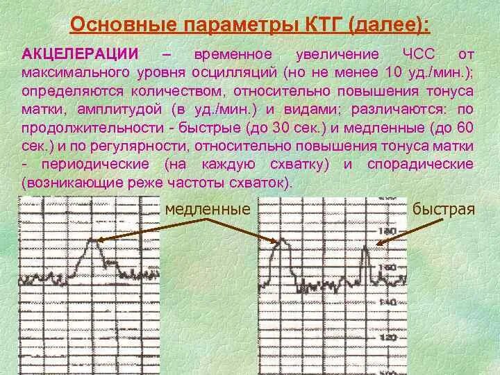 Сила схватки. КТГ. Оценка параметров КТГ. Патологический Тип КТГ плода. График КТГ.