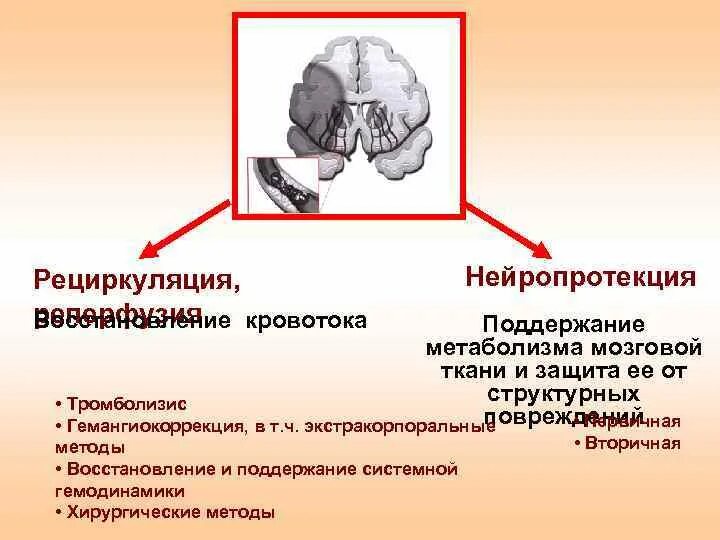 Нейропротекция. Нейропротекция при инсульте. Нейропротекция при ишемическом инсульте. Гемодинамика и метаболизм головного мозга. При церебральной коме для нейропротекции используют.