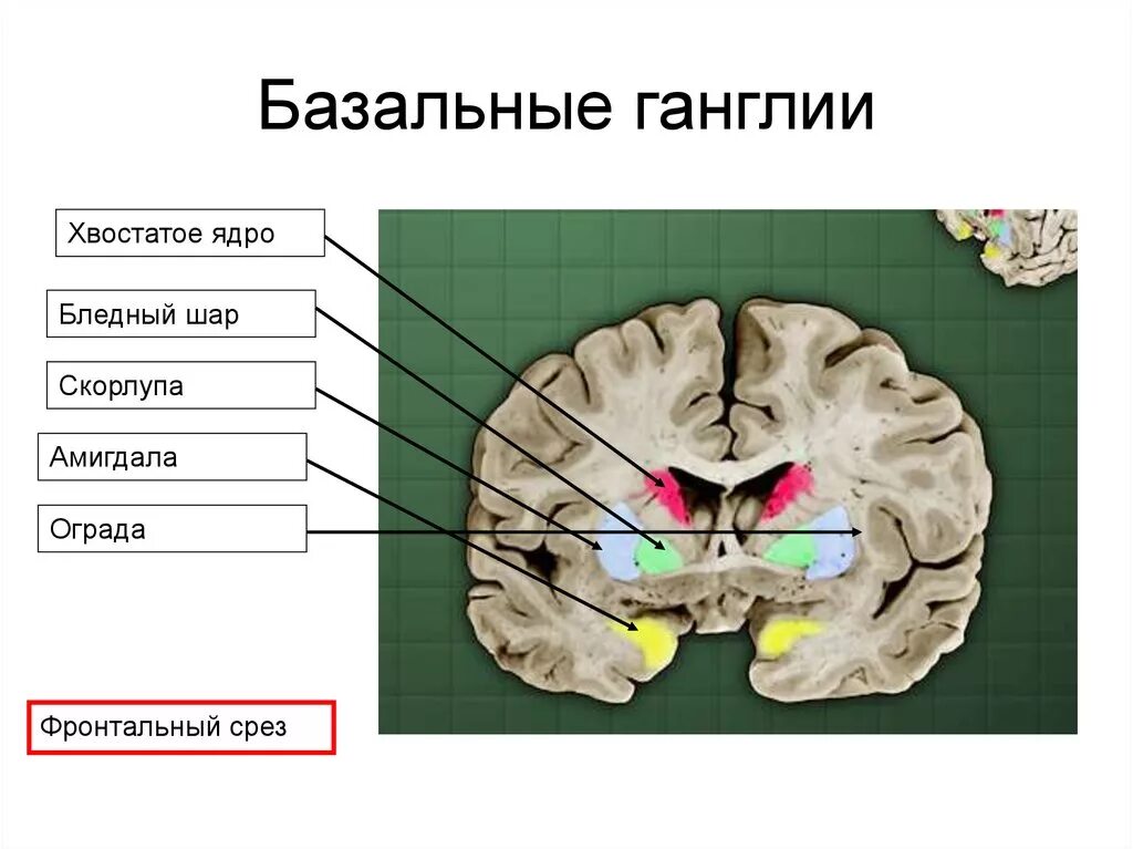 Хвостатое ядро мозга. Бледный шар скорлупа хвостатое ядро. Подкорковые ядра (чечевицеобразное, скорлупа, бледный шар). Базальные ганглии ядро скорлупа бледный шар. Бледный шар скорлупа чечевицеобразное ядро.