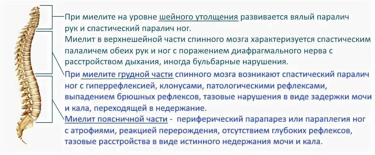 Боль в спинном мозге. Миелит неврология симптомы. Миелит грудного отдела спинного мозга. Симптомы поперечного миелита на грудном уровне спинного мозга. Острый поперечный миелит неврология.