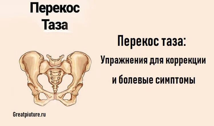 Как выровнять таз. Упражнения при смещении тазовых костей. перекос таза упражнения. перекос таза лфк. упражнения для выравнивания таза.
