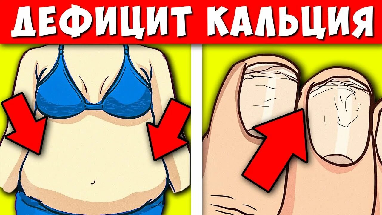 Как восполнить дефицит кальция в организме. Недостаток кальция. дефицит кальция. признаки дефицита кальция. недостаток кальция в организме.