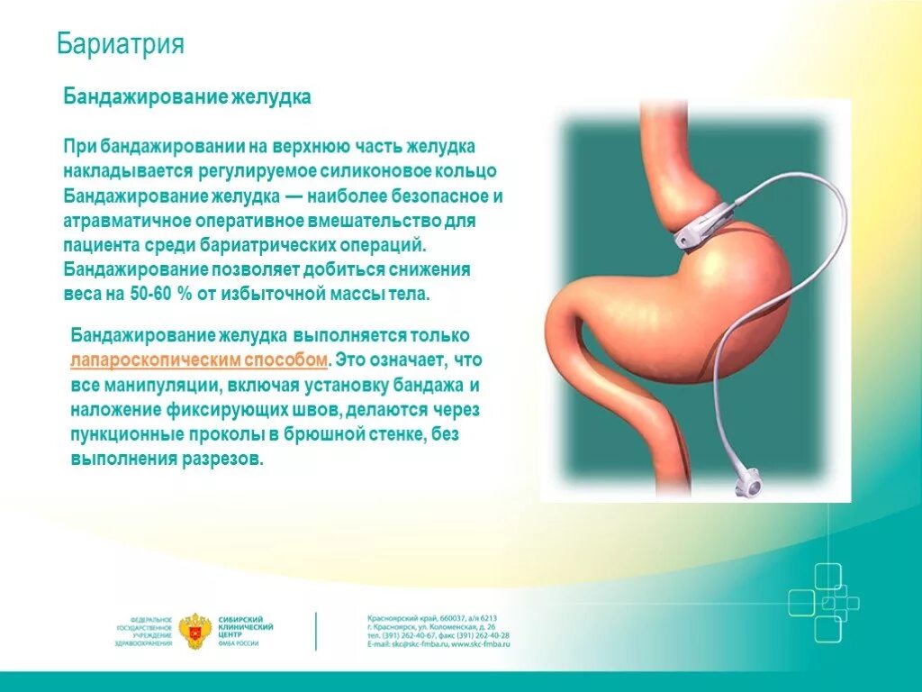 Бариатрическая операция ростов. Бандажирование желудка. Бариатрическая операция на желудке.