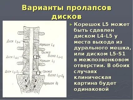 Дуральный мешок деформирован