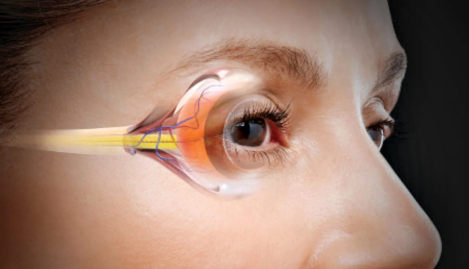 Что делать при глаукоме глаза. Глаукома внутриглазное. Глоэкома. Глколюкома.