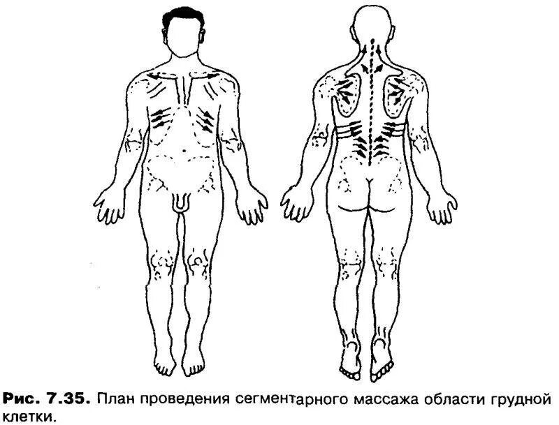 Направление массажных движений при массаже. Массаж схемы выполнения. Схема проведения массажа. Массаж воротниковой зоны схема. Массаж спины схема.