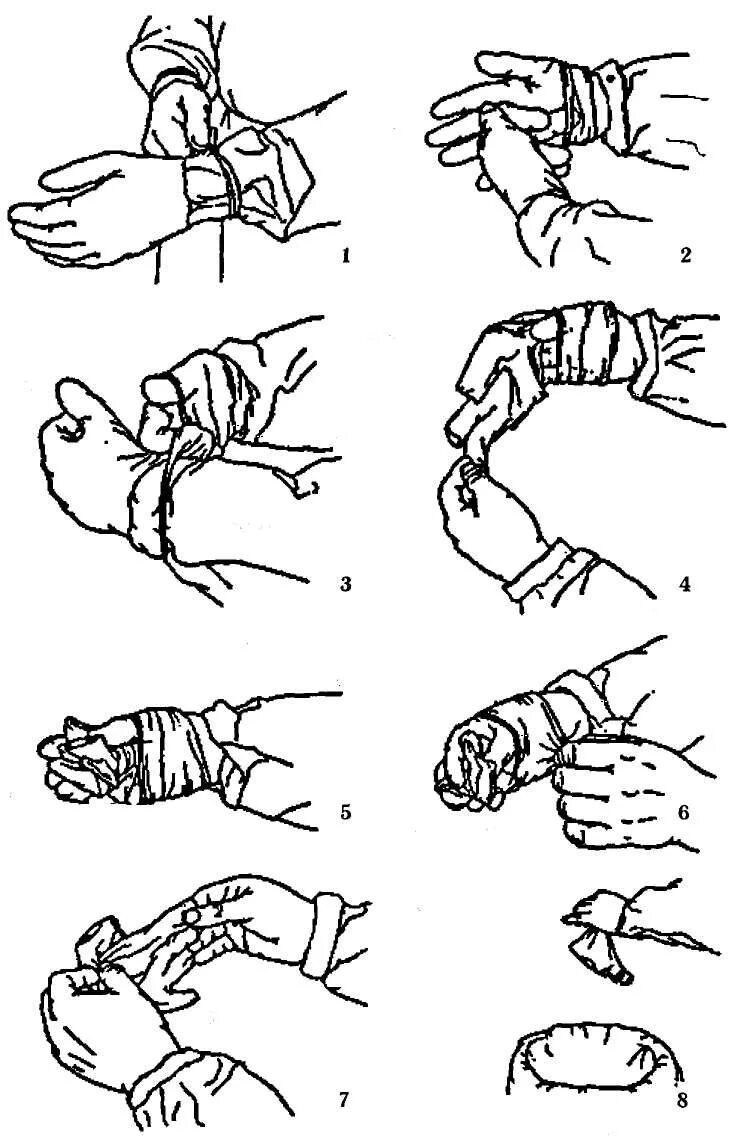 Перчатка алгоритм. Схема надевания стерильных перчаток. Схема одевание и снятие стерильных перчаток. Надевание стерильных перчаток алгоритм. Техника надевания стерильных перчаток.