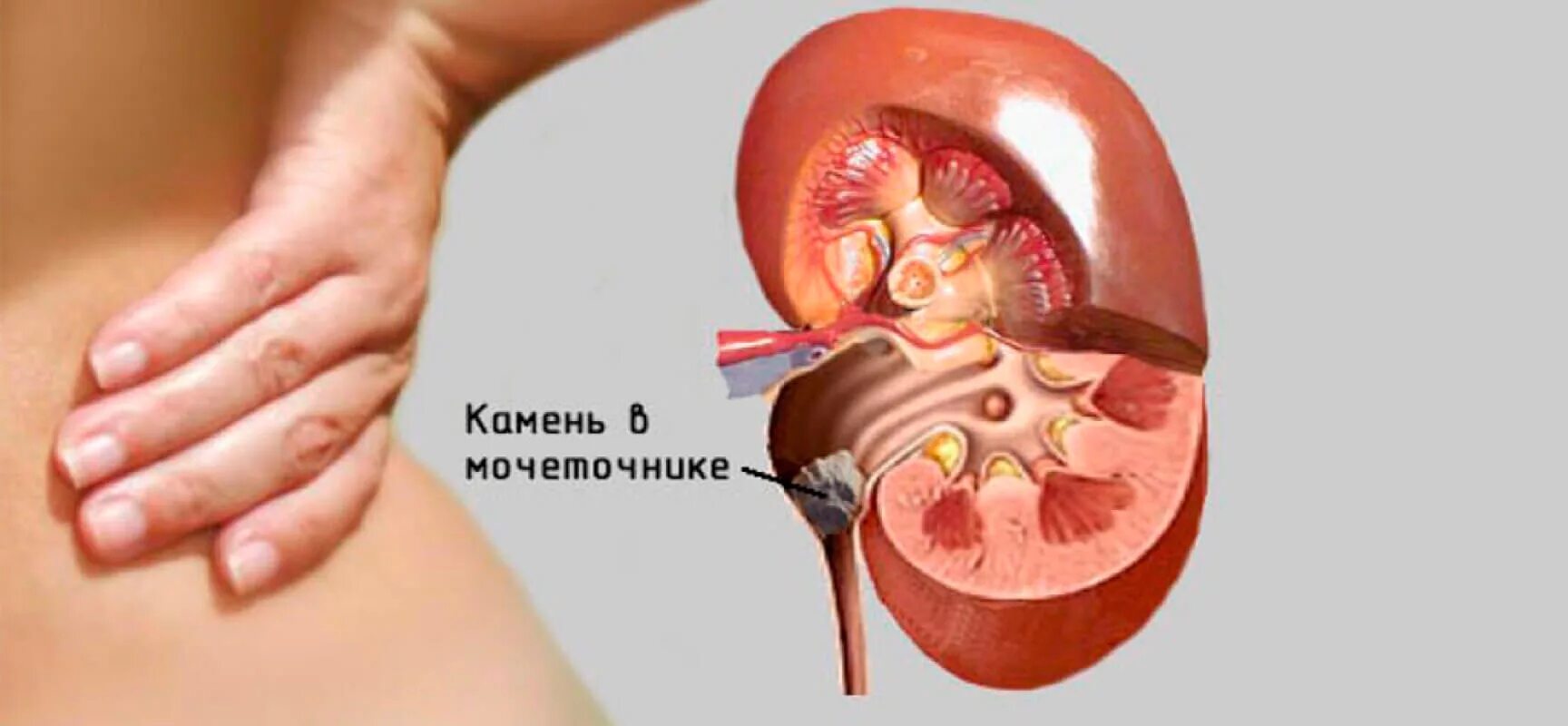 Камень больно