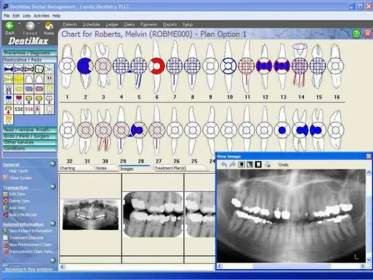 Программа для стоматологической клиники. Программа dental. программа для стоматологических снимков. программа для стоматологической клиники dental. программа для моделирования зубов в стоматологии.