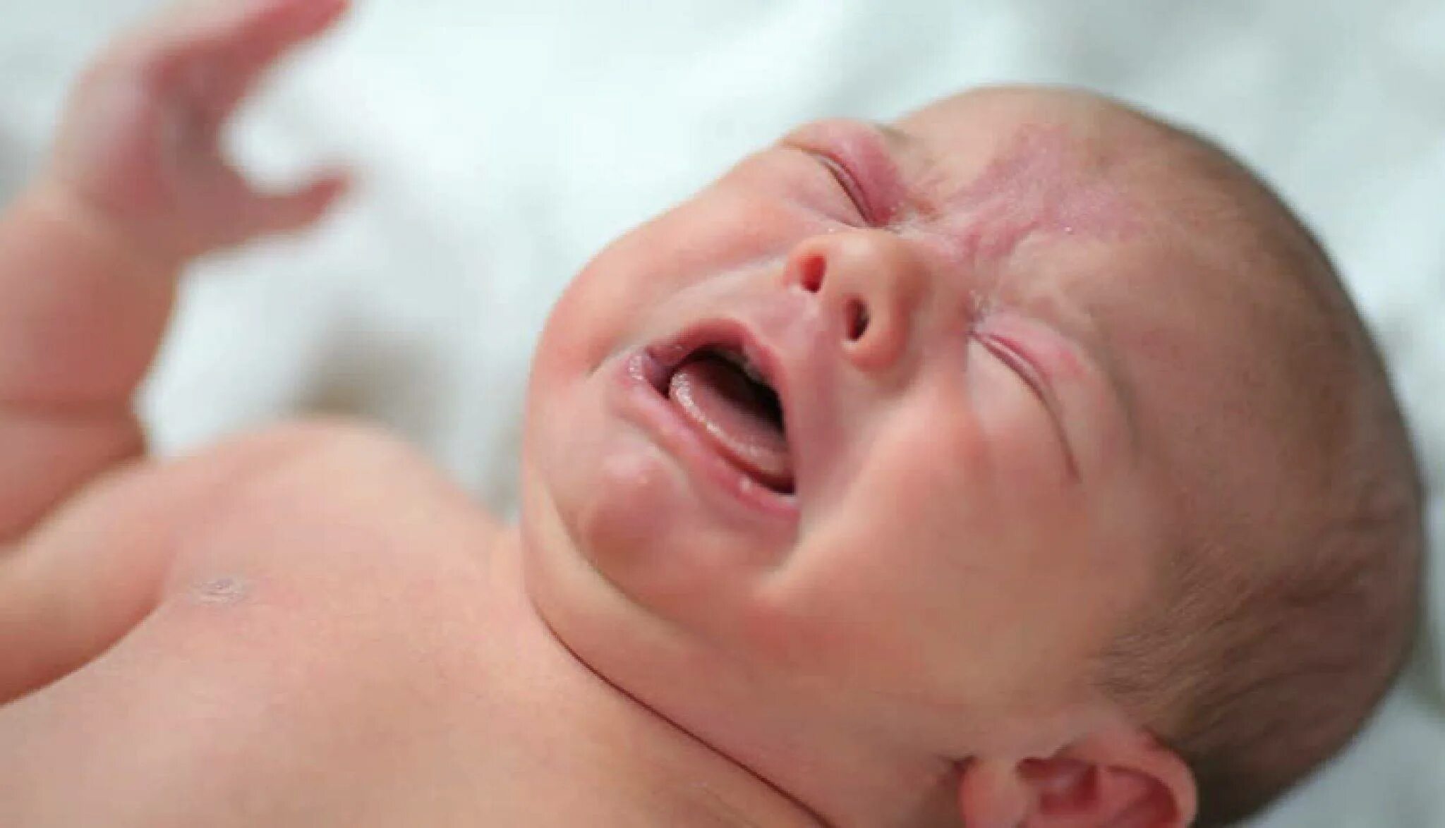 Цианоз носогубного треугольника у новорожденных. Цианоза носогубгого треугольника. Синюшность носогубного треугольника. Цианоз при врожденных пороках сердца у детей.