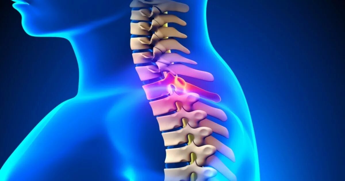 Блокада спины цена. Позвоночник человека. Блокада грыжи позвоночника. Позвоночник фото.