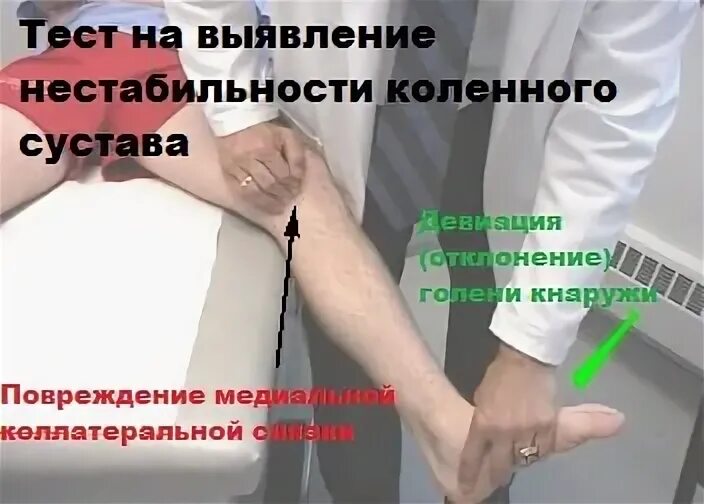 Нестабильность суставов
