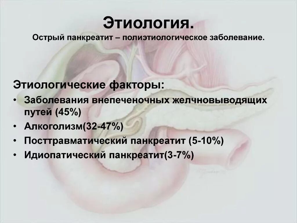 Исход панкреатита. Этиопатогенез панкреатита. Острый панкреатит этиология. Этиология острого панкреатита хирургия. Идиопатический хронический панкреатит.