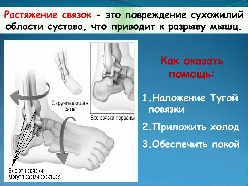 Оказание первой помощи при переломах вывихах ушибах. Оказание пмп при растяжении связок. Растяжения и разрывы связок суставов. Порядок оказания первой помощи при вывихе. Пмп при переломах и вывихах растяжениях ушибах.