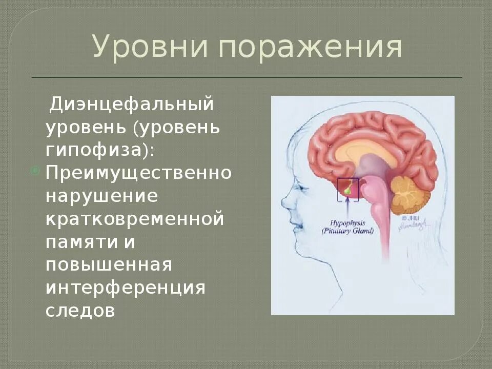 Диэнцефальная дисфункция головного мозга. Диэнцефальные структуры. Диэнцефальные структуры мозга. Диэнцефальные отделы мозга это. Гипоталамо диэнцефальные структуры.