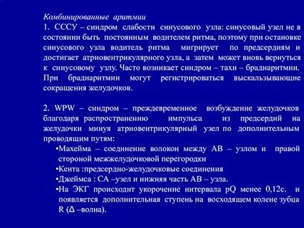 Синдром синусового узла лечение