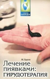Вам поможет пиявка
