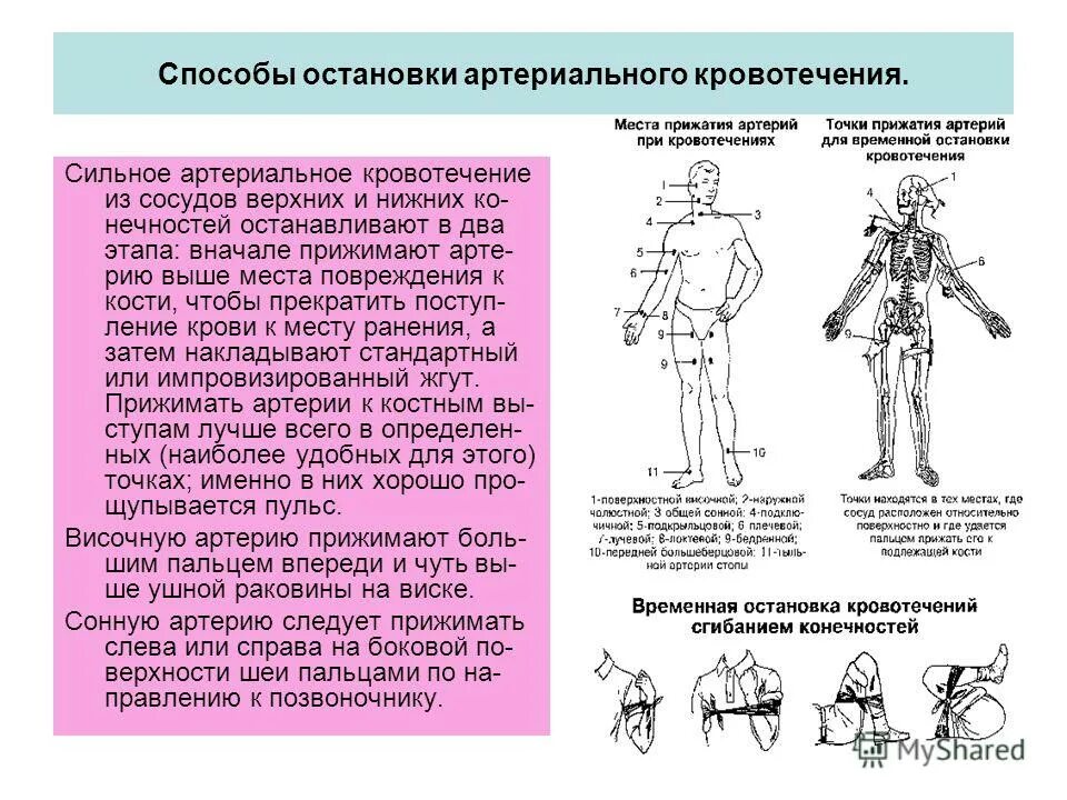 Какие методы остановки использовать. Два этапа остановки артериального кровотечения верхних и нижних. этапы остановки артериального кровотечения из сосудов конечностей. артериальное кровотечение из сосудов верхних и нижних конечностей. методы остановка кровотечений артерий и вен.