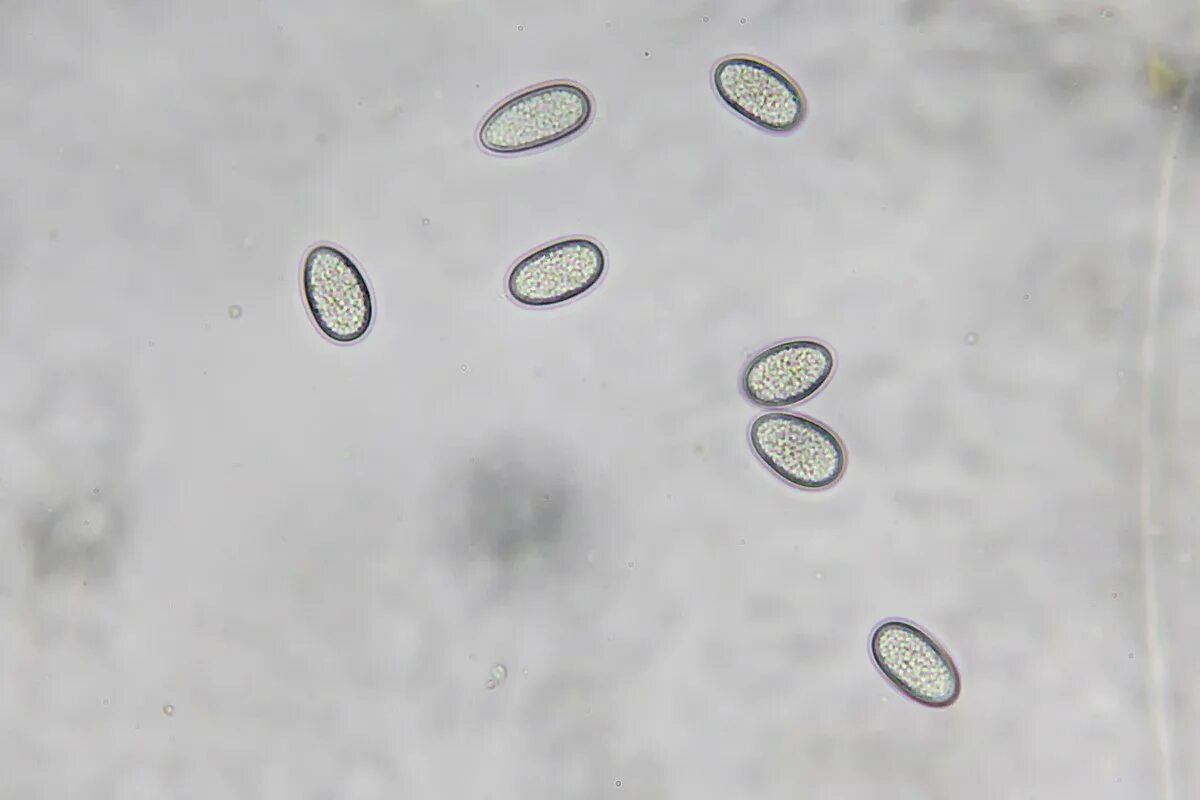 Спора особая клетка. Споры под микроскопом. Спора в микроскопе. Споры микроскопия. Споры мха под микроскопом.