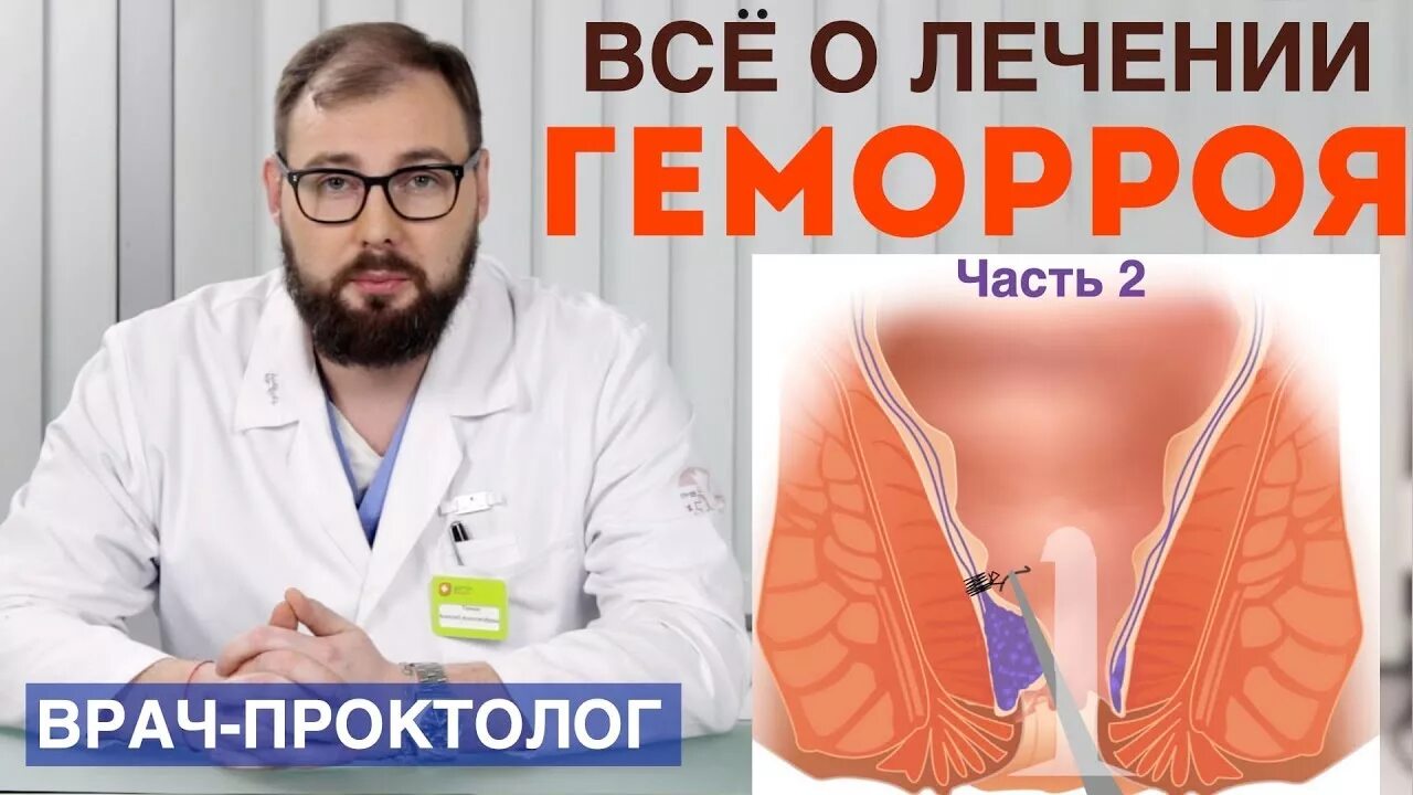 Проктолог удаление