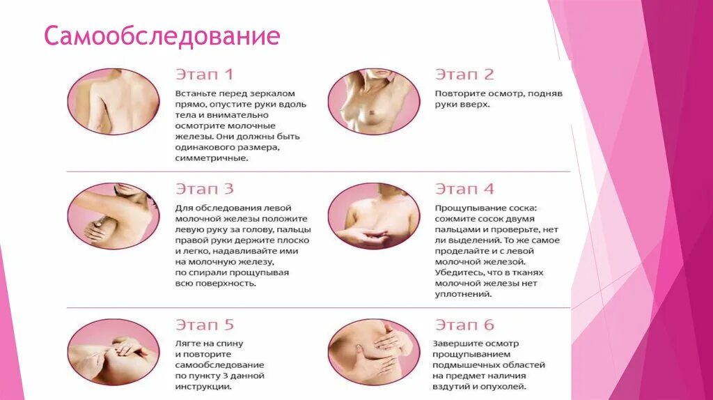 Обучение самообследованию молочных желез. Методика самообследования молочных желез. как проверить молочную железу самостоятельно. этапы самообследования молочной железы. самообследование молочной железы памятка.
