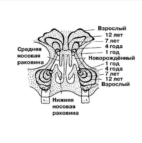 Аденэктомия. Формирование пазух носа у детей по годам. Особенности строения пазух носа у детей. Придаточные пазухи носа строение. Околоносовые пазухи носа анатомия.