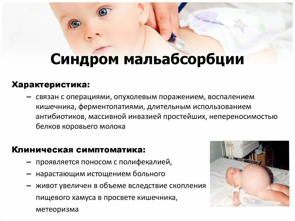 Основные причины развития синдрома мальабсорбции. Клинические проявления синдрома мальабсорбции. Симптомы мальабсорбции кишечника. Симптомы мальабсорбции кишечника. Симптомы мальабсорбции кишечника.