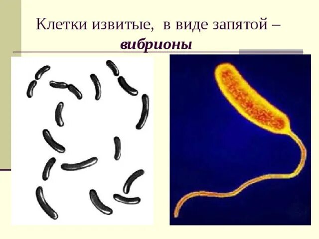 Бактерии изогнутой формы носят название. Извитые вибрионы. Извитые бактерии вибрионы. Форма бактерии вибрионы. Вибрионы в виде запятой бактерии.