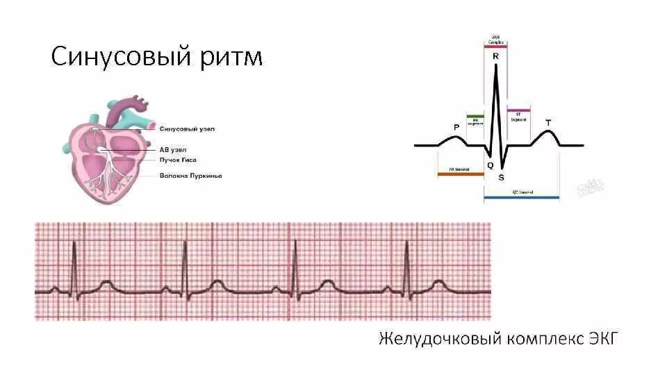 Синусовый ритм сердца у взрослого женщины. Электрокардиограмма показатели синусовый ритм. синусовый и несинусовый ритм экг. нормальный синусовый ритм сердца на экг. экг расшифровка синусовый ритм.