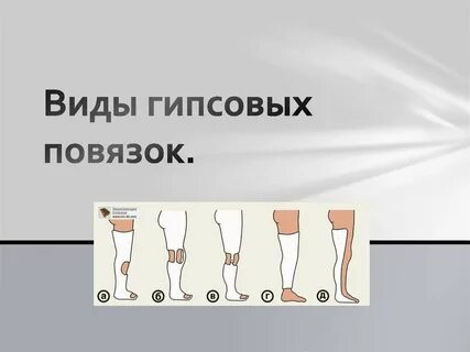Разновидность гипса