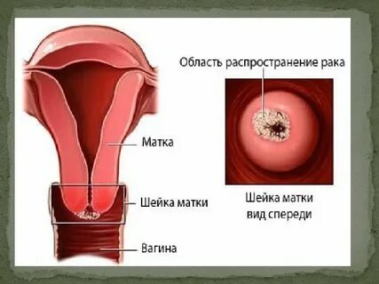 Область матки