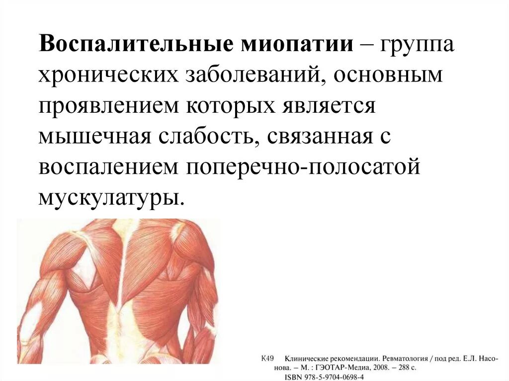 Миопатия что это за болезнь. Воспалительные миопатии. Клиническое проявление заболевания мышц.