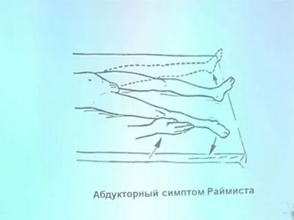 Синкенезия это