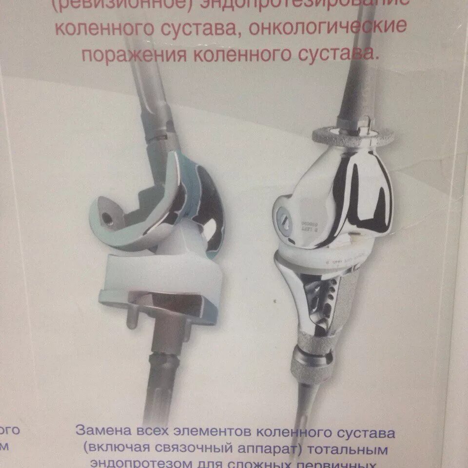 эндопротез коленного сустава smith nephew. производители коленных эндопротезов. сесамовидная кость коленного сустава фабелла. эндопротез зиммер коленного сустава. коленный эндопротез stryker.