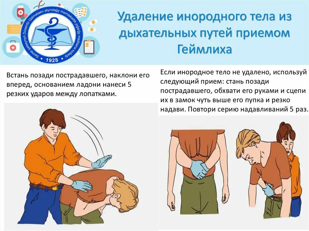 Приемы удаления инородных тел. Если человек подавился прием геймлиха. подавился метод хаймлиха. приём геймлиха при инородном теле. удаление инородного тела из дыхательных путей приемом геймлиха.