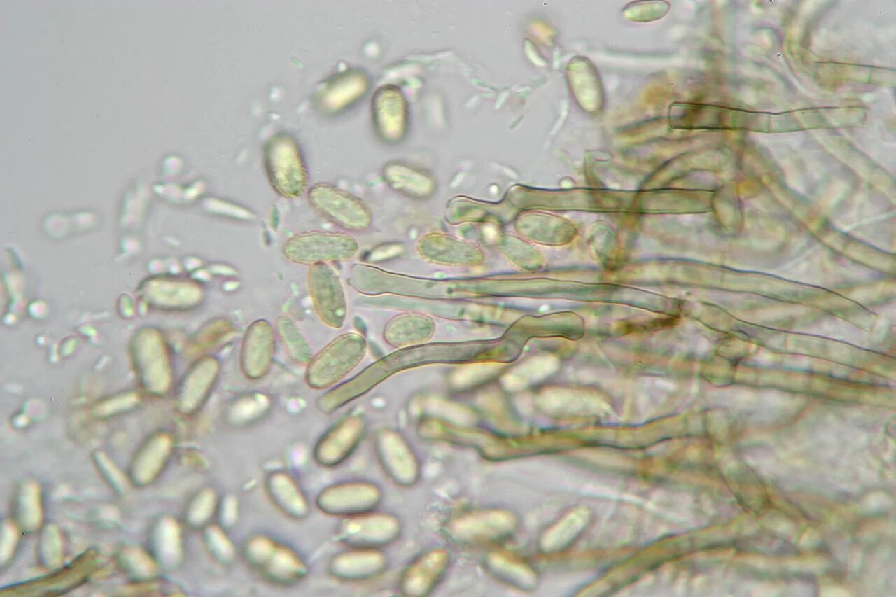 Обнаружены споры и мицелий. Конидии фитофторы. Конидии грибов микроскоп. Споры конидии. Фомопсис конидии.