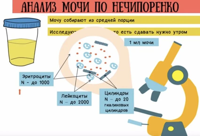 Моча по нечипоренко для чего. Для проведения анализа мочи по методу нечипоренко. для исследования мочи по методу нечипоренко собирают. исследование мочи по нечипоренко алгоритм. сбор мочи по нечипоренко емкость.