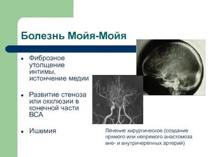 Болезнь моя моя
