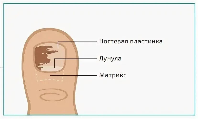 Что такое матрикс ногтя
