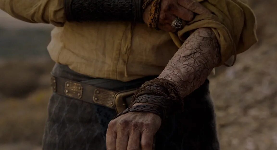 Джорах мормонт серая хворь. Хворь. Джорах мормонт болезнь. Хворь. Джорах мормонт серая хворь.