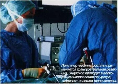 Какие операции на предстательной железе