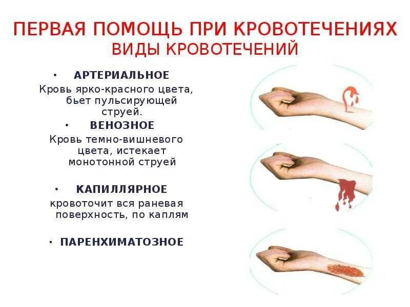 Оказание первой помощи остановки наружного кровотечения. Оказание первой помощи при различных кровотечениях. оказание первой помощи пострадавшему при кровотечении. основные приемы оказания первой помощи при кровотечении. алгоритм оказания первой помощи при наружном кровотечении.