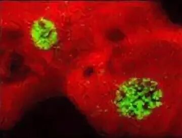 Сходства вирусов и клеток. Самый большой вирус. Как называются самые крупные вирусы. Мимивирус. Коронавирус.