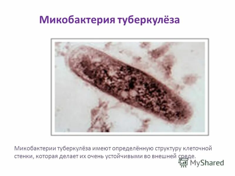 Возбудителем туберкулеза является палочка коха. Строение стенки микобактерии туберкулеза. строение микобактерии туберкулеза. микобактерии возбудители туберкулеза. микрокапсула микобактерии туберкулеза.