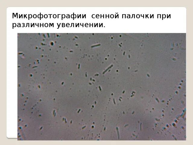 Гнилостные бактерии питание. Бактерии Bacillus subtilis. Картофельная палочка бактерия. Гнилостные бактерии Сенная палочка. Картофельные палочки.