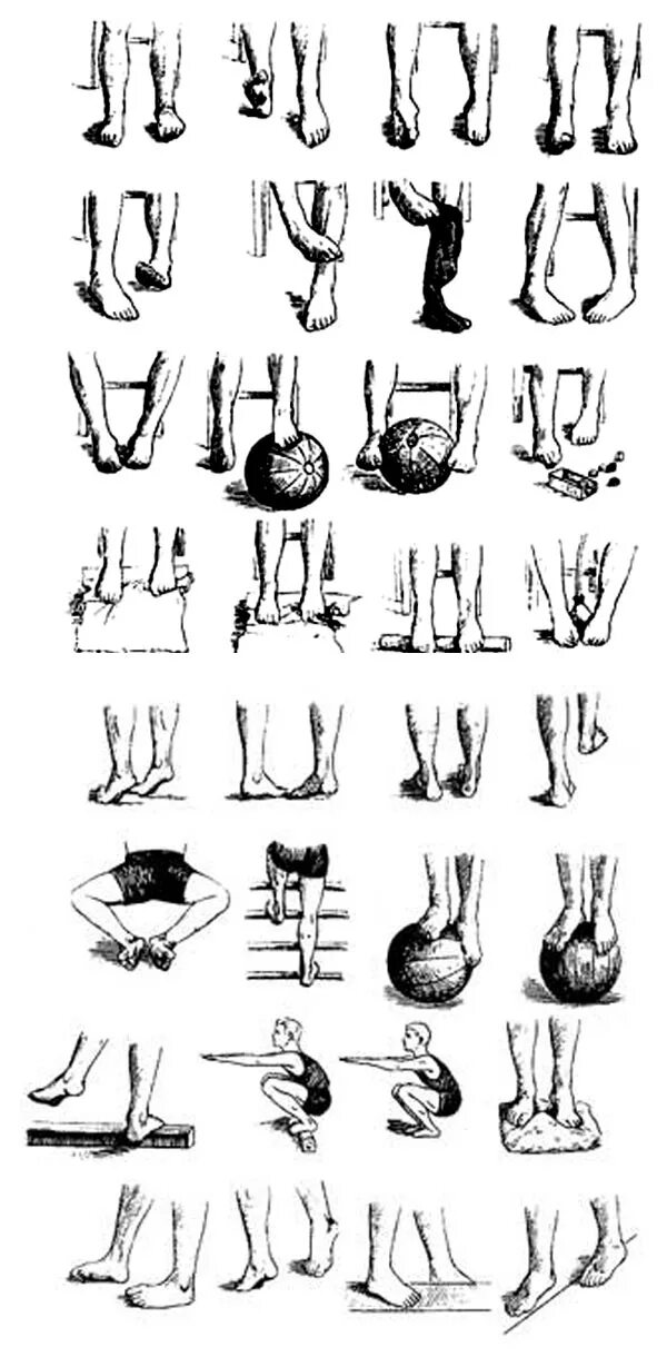 Комплекс упражнений для стопы. ЛФК при плосковальгусной деформации стоп у детей. Массаж для стоп при вальгусной деформации стопы у детей. Упражнения при вальгусе стоп у детей. Упражнения для ног при вальгусной деформации у детей.