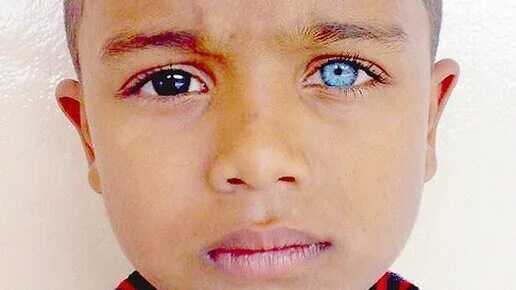 Люди с 2 днк. Люди с 2 днк. Тейлор мул химеризм. Лидия фэйрчайлд американка в 2002 году. Люди с 2 днк.